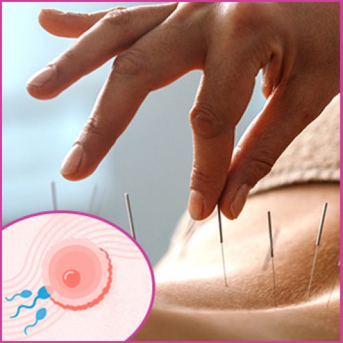 Acupuncture for Fertility Treatment: Does it Work?