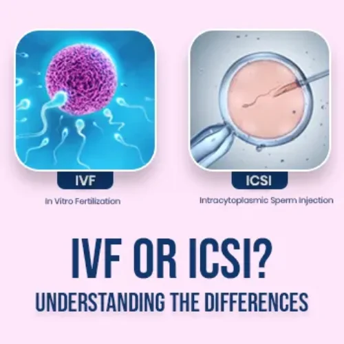 IVF or ICSI? Understanding the Differences
