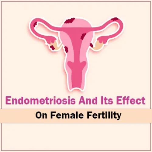 Endometriosis And Its Effect On Female Fertility blog featured image