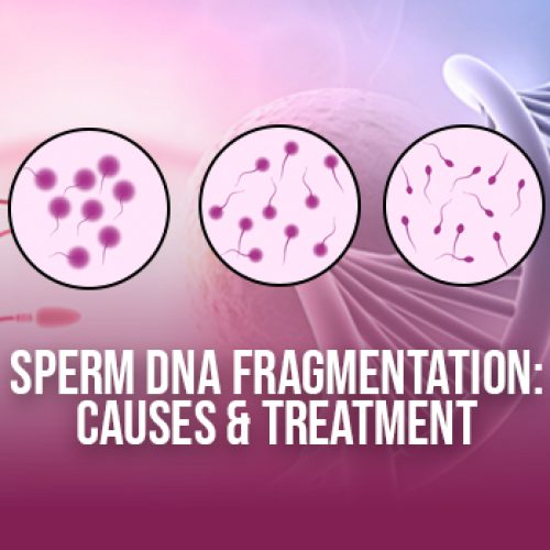Sperm DNA fragmentation Causes & Treatment images